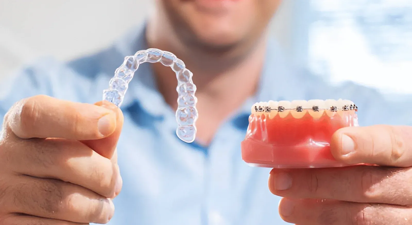 A Complete Guide to Braces and Aligners in Chintal