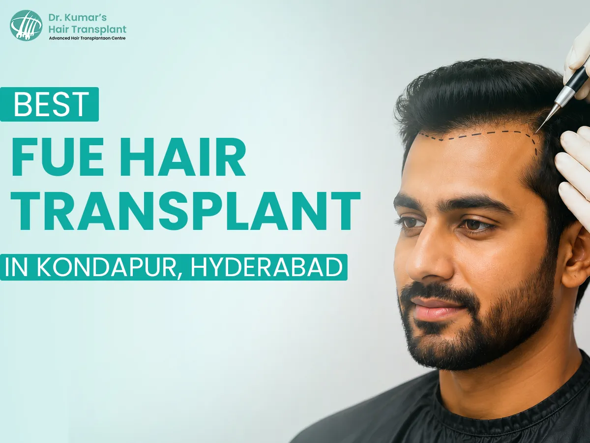 Thinking About a Hair Transplant? Here Is What You Should Know Before You Decide