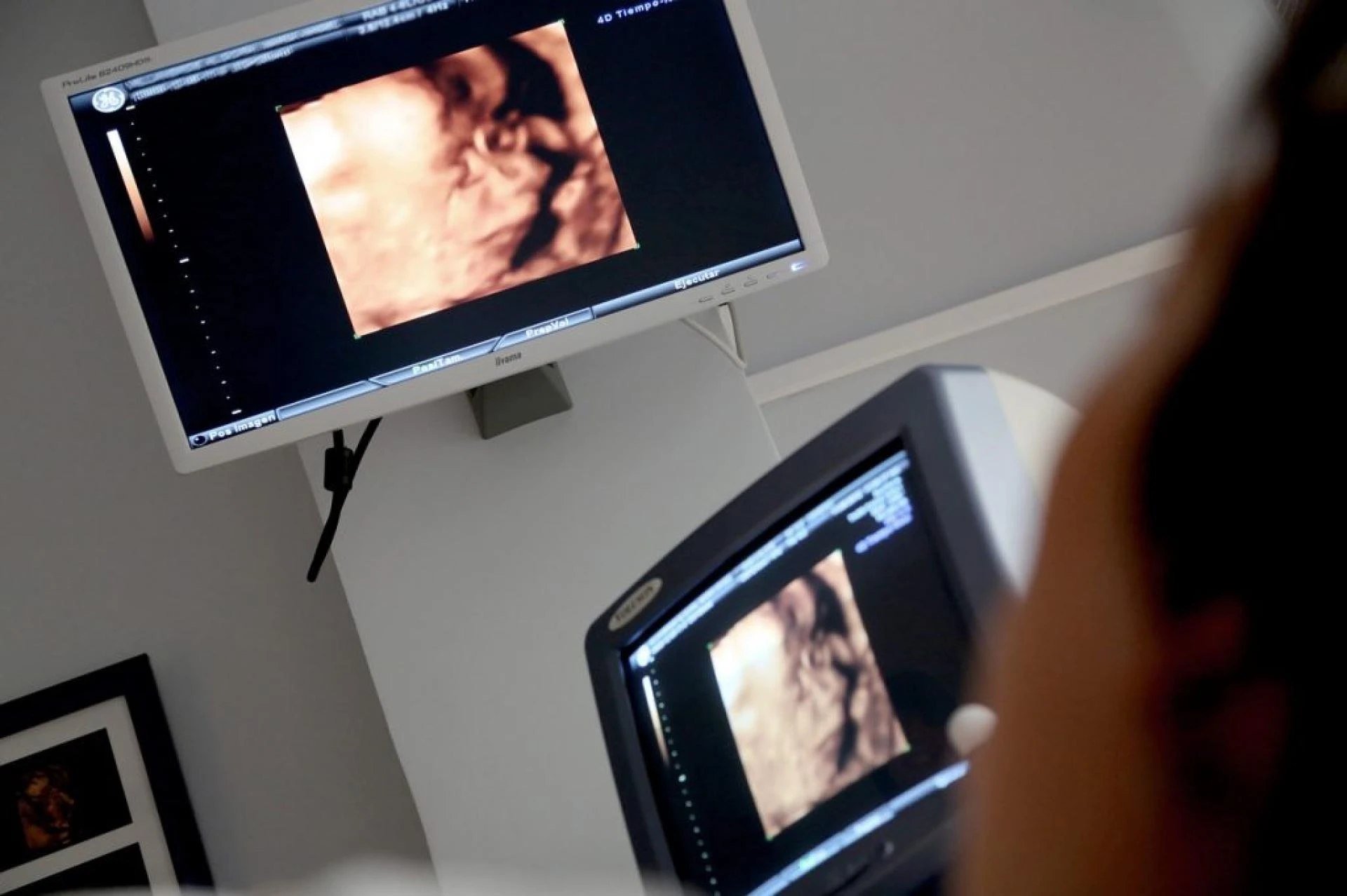 How To Choose The Right Private Ultrasound Clinic In Perth For Your Needs