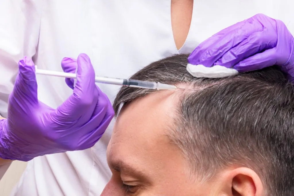 Does PRP Hair Treatment Work for Early Hair Loss?