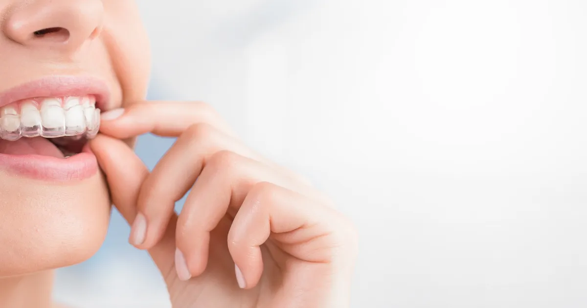 Invisalign Brampton: A Clear Path to a Straighter, More Confident Smile