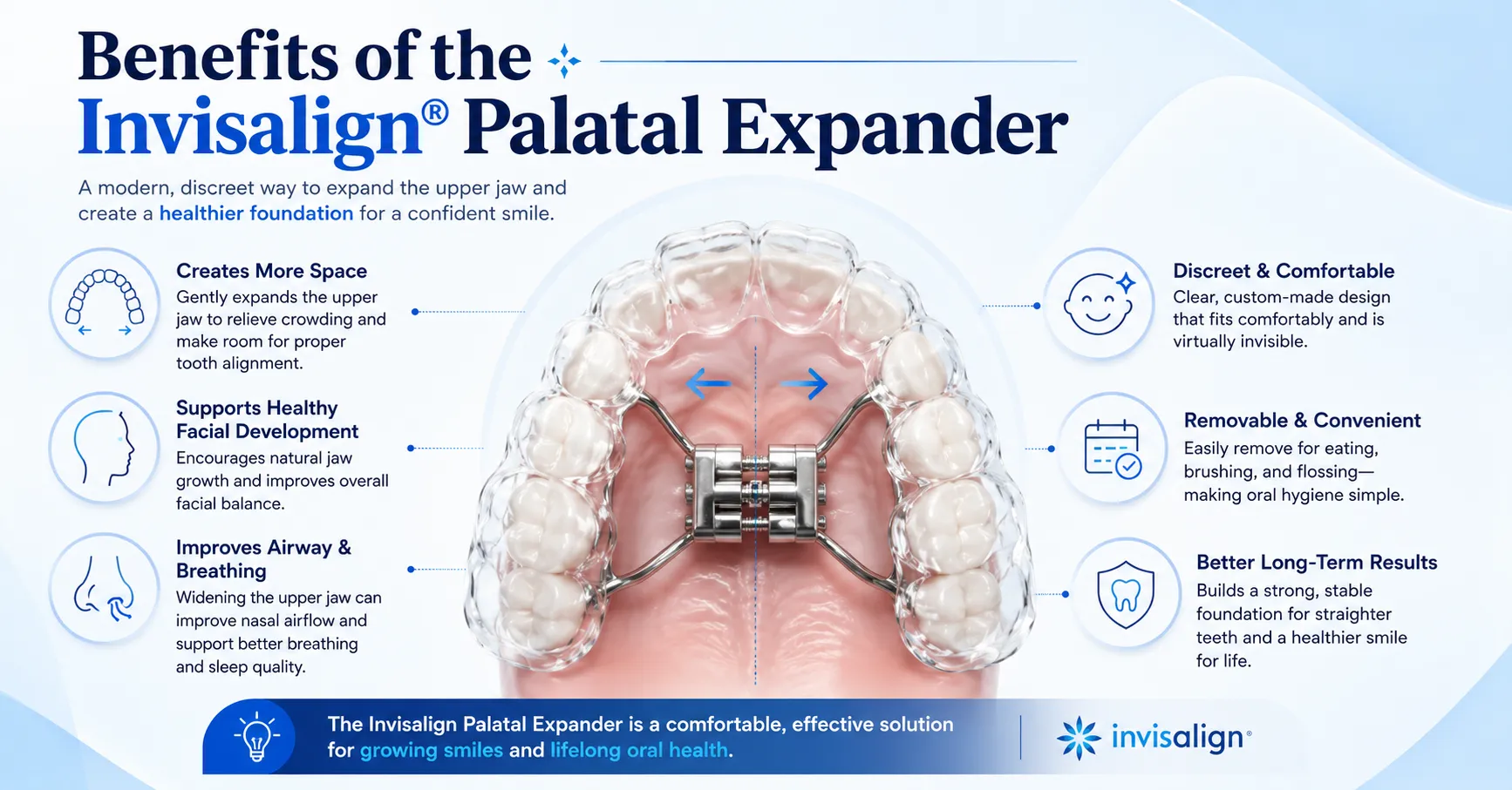 Invisalign Palatal Expander