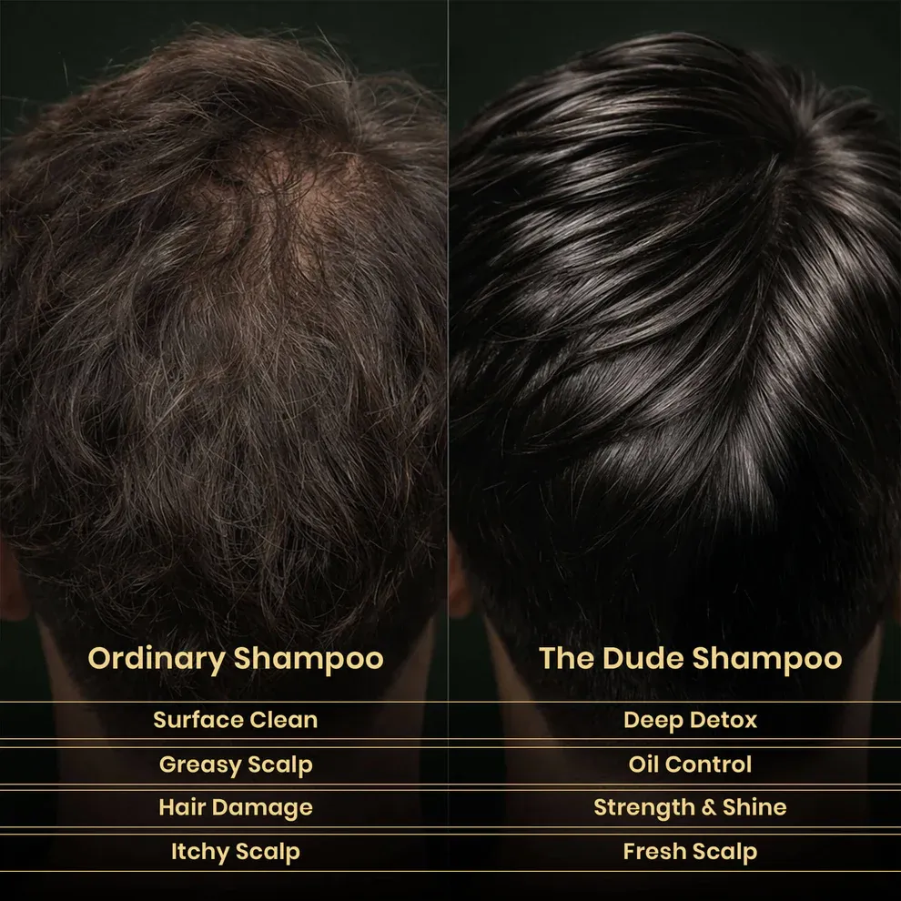What Makes Shampoo for Thinning Hair Effective for Hair Care?