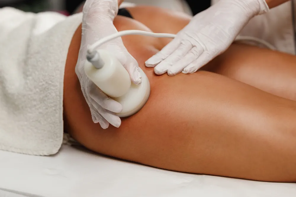 What Cellulite Treatment Works for Men’s Cellulite?