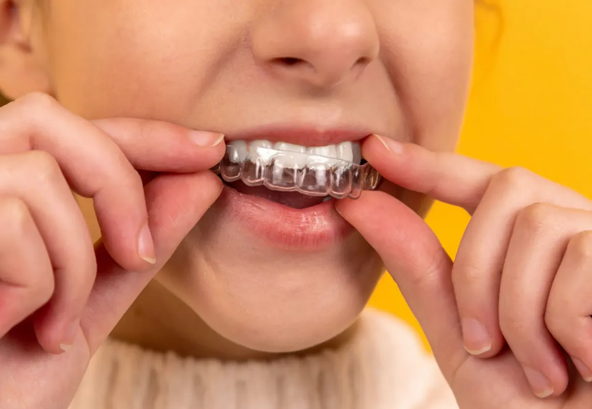 How Long Does Invisalign Take? Finding Fast, Effective Treatment for a Straighter Smile