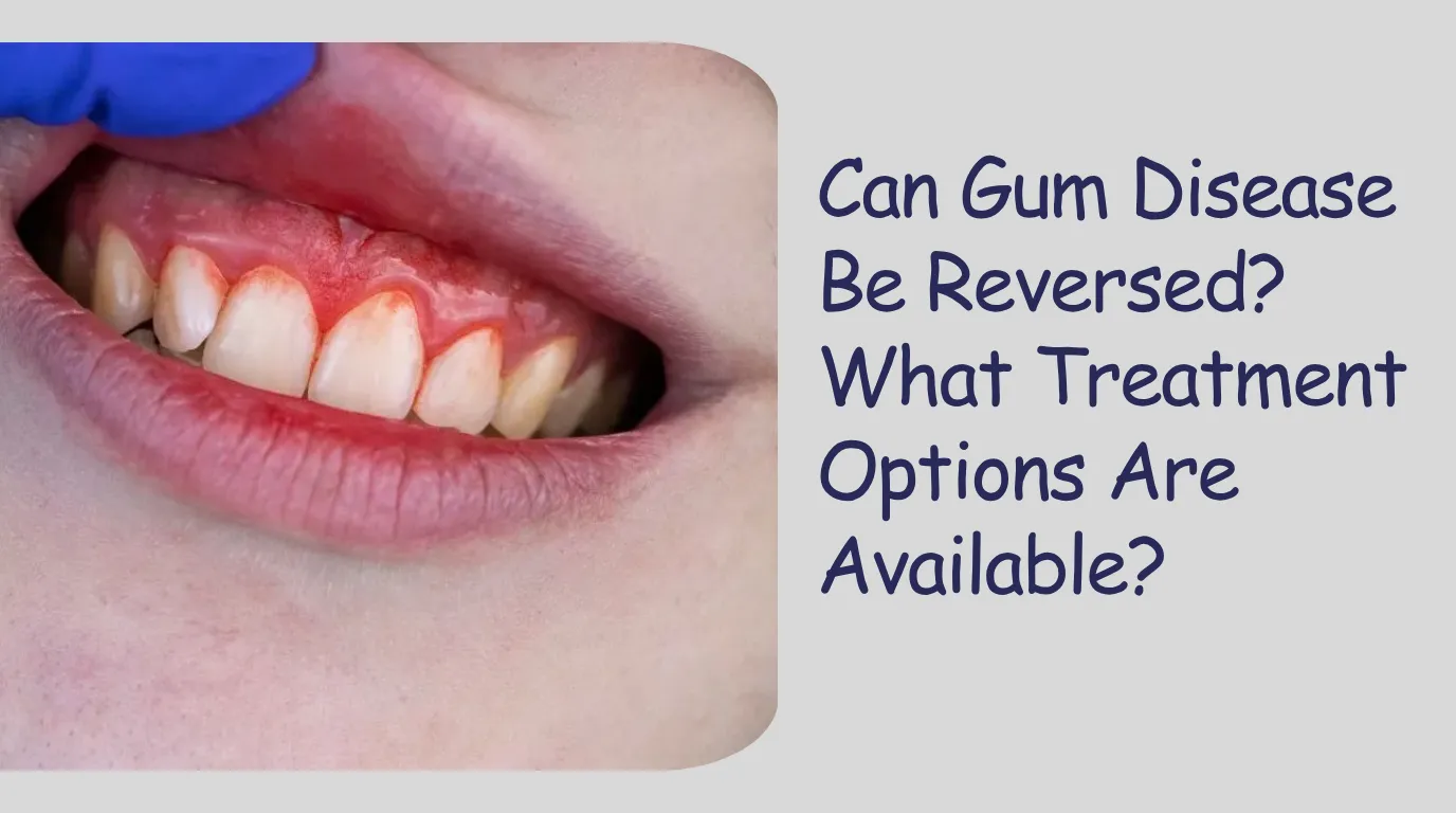 Can Gum Disease Be Reversed? What Treatment Options Are Available?