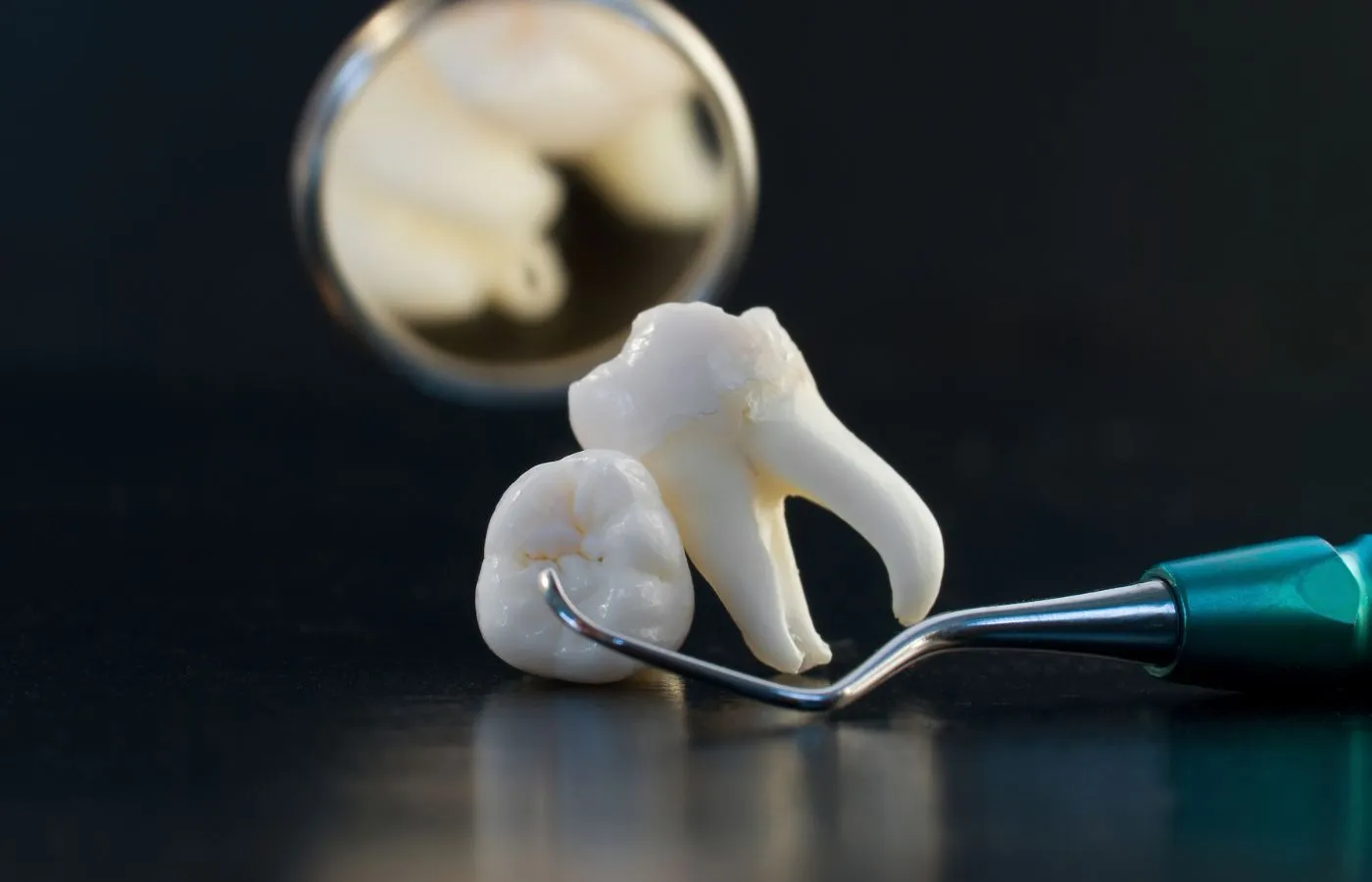 Wisdom Tooth Removal: Your Guide for a Quick Recovery