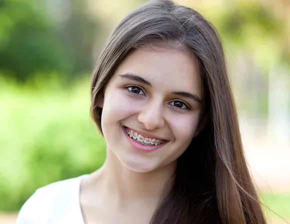 Finding Affordable Braces Options in Las Vegas