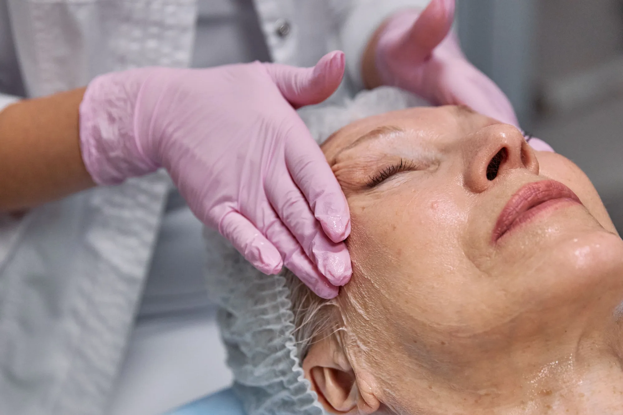 Benefits of Choosing a Non-Surgical Facelift London Treatment