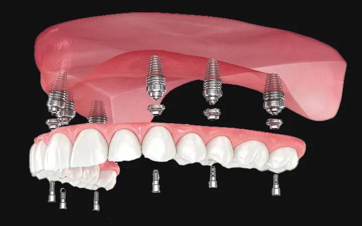 Premium Family Dental Solutions: Elevating Oral Healthcare in Lahore