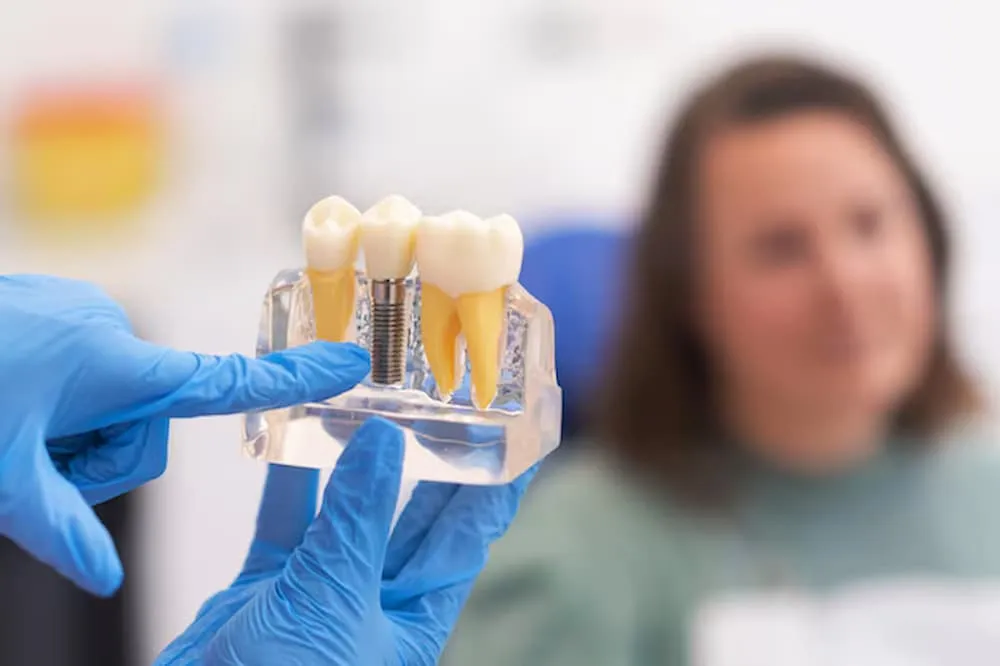 Benefits of Choosing Dental Implants Near Me Over Dentures