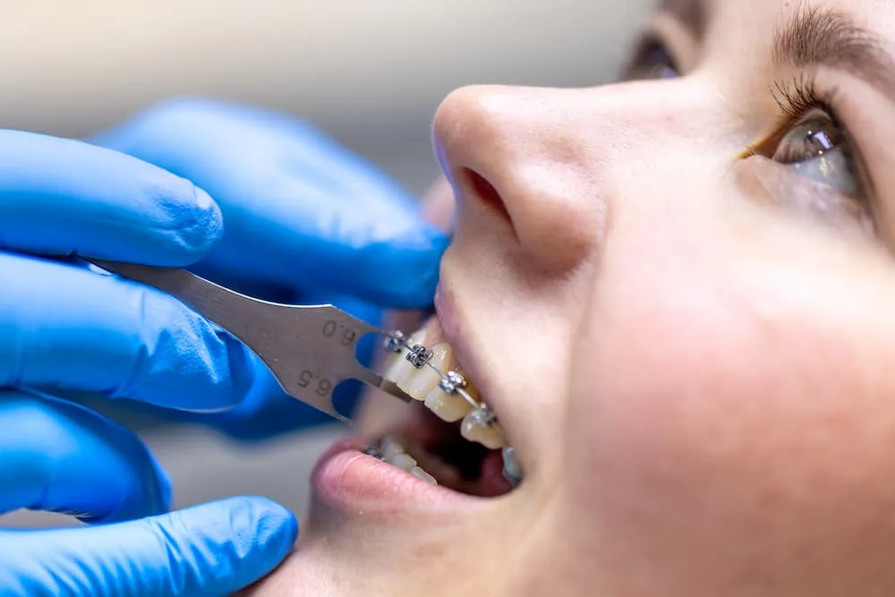 Advanced Technology Used for Dental Bridges in Powder Springs