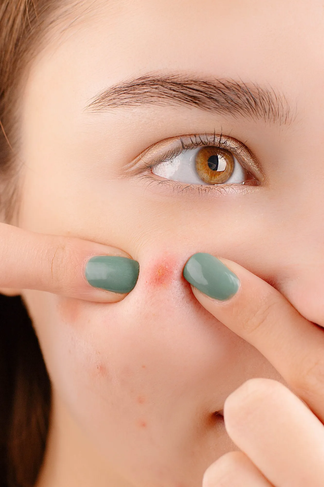 What Is Microneedling? Benefits, Procedure & Recovery Guide