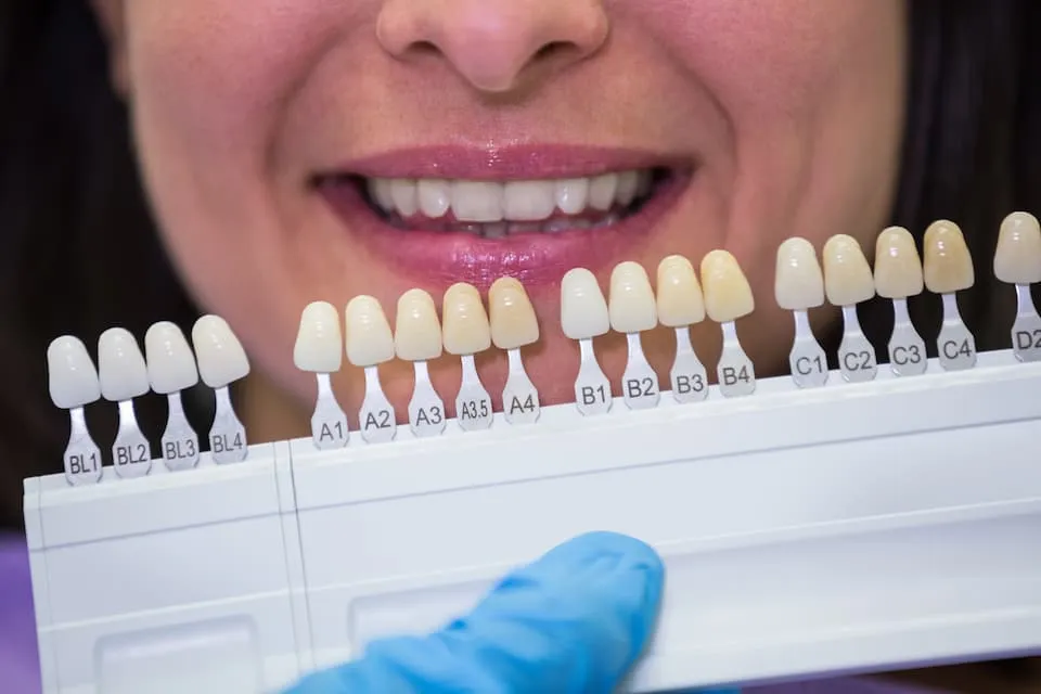 How to Choose the Right Clinic for Veneers Teeth Turkey