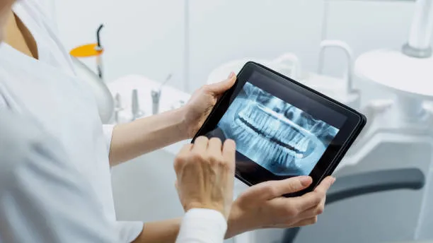 Can a Local Implant Dentist Near Simi Valley Really Change Your Life?