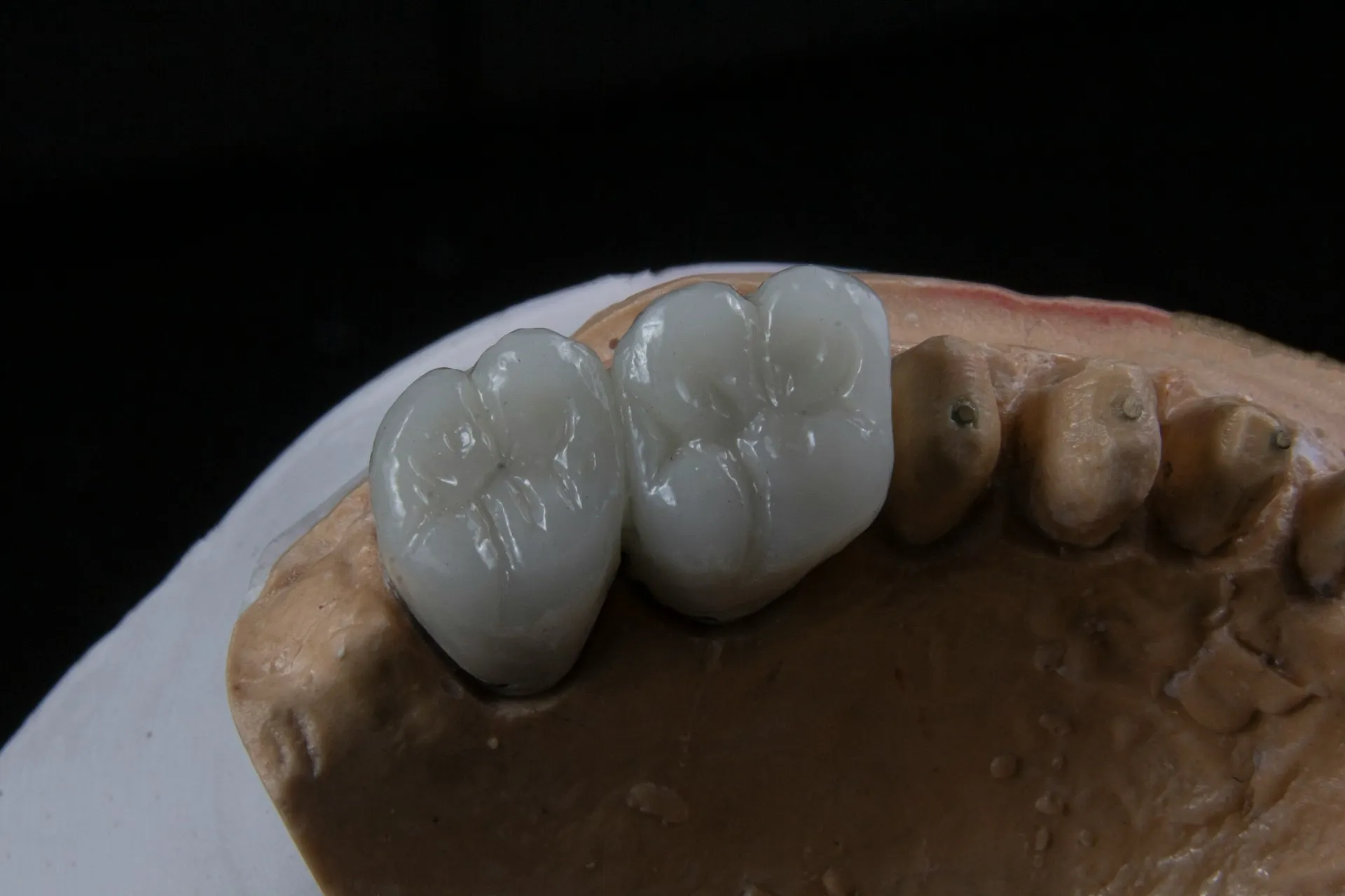 Find Dental Crowns Near Me For Reliable And Long Lasting Tooth Repair