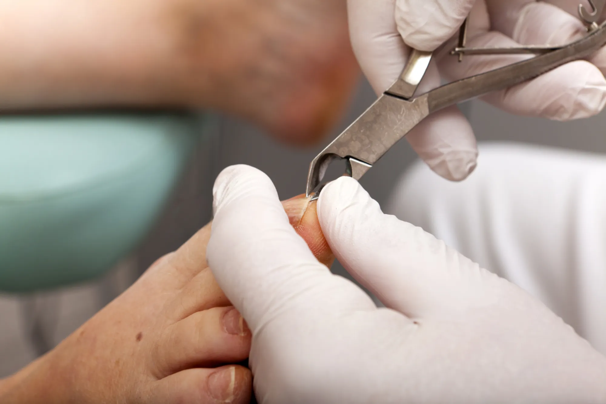 Choosing the Right Foot Clinic in Calgary: Expert Tips