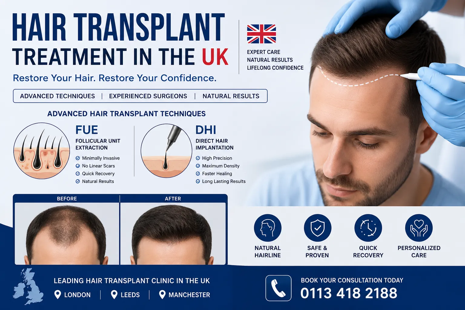 Hair Transplant Surgery UK: Expert Insights on Modern Hair Restoration