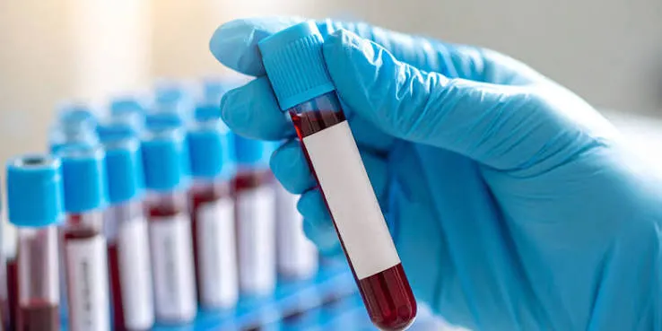 Book Your Blood Test In Nagpur Today and Take Charge of Your Health