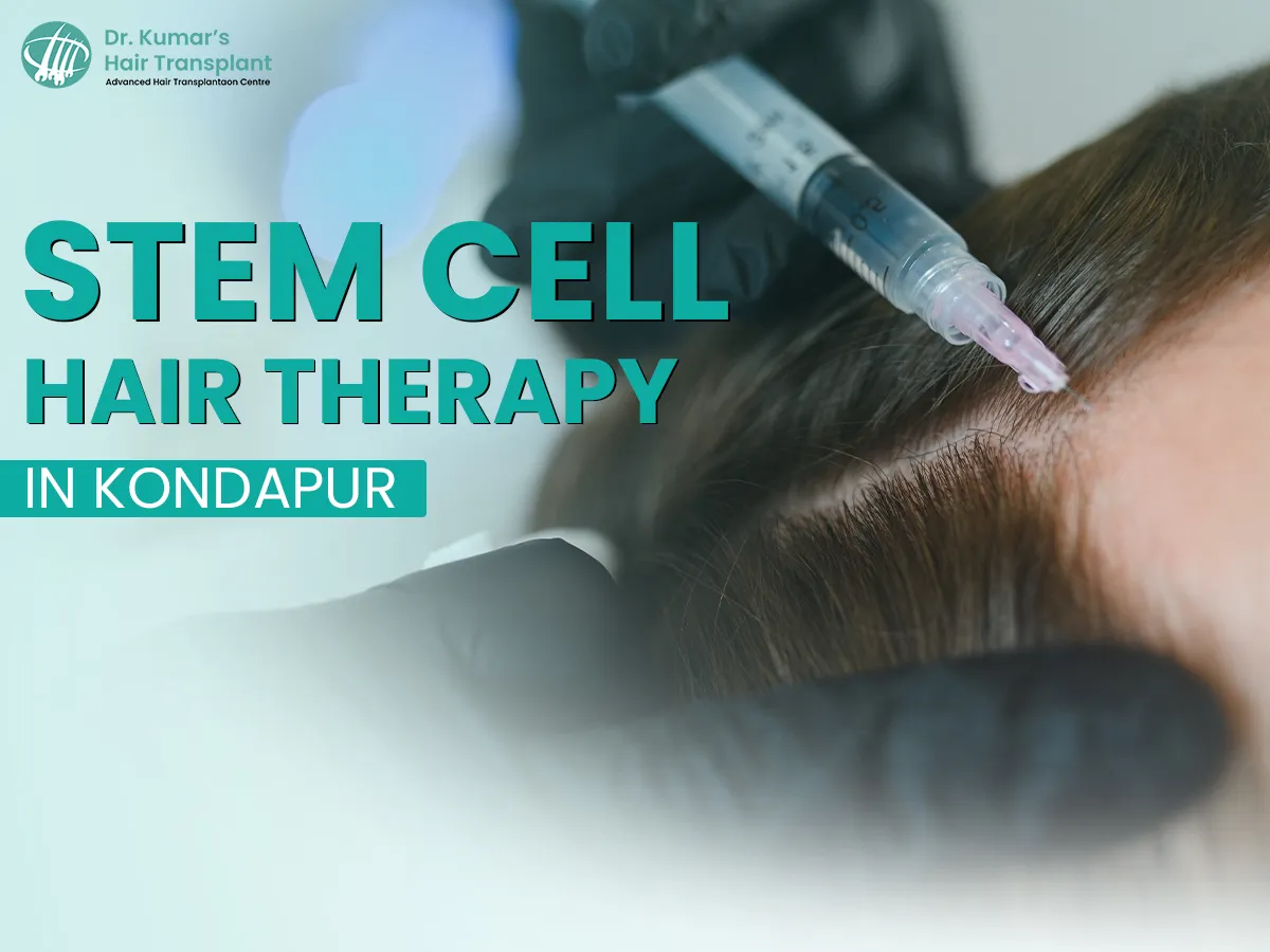 Stem Cell Hair Therapy: A New Hope for People Dealing with Hair Loss