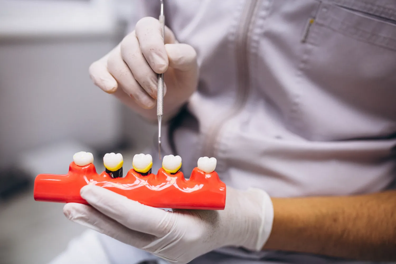 Restoring Confidence with Dental Implants in Lake Mary