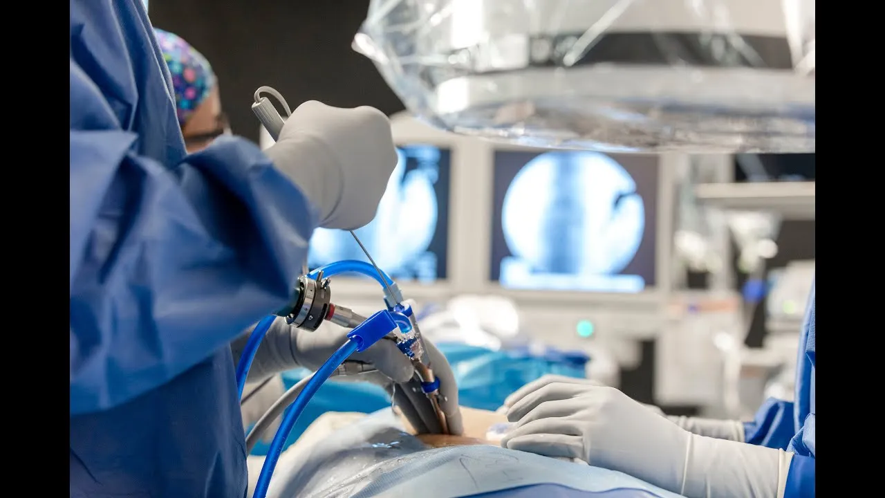 Spine Surgery Recovery Timeline: What Patients Can Expect and How to Decide