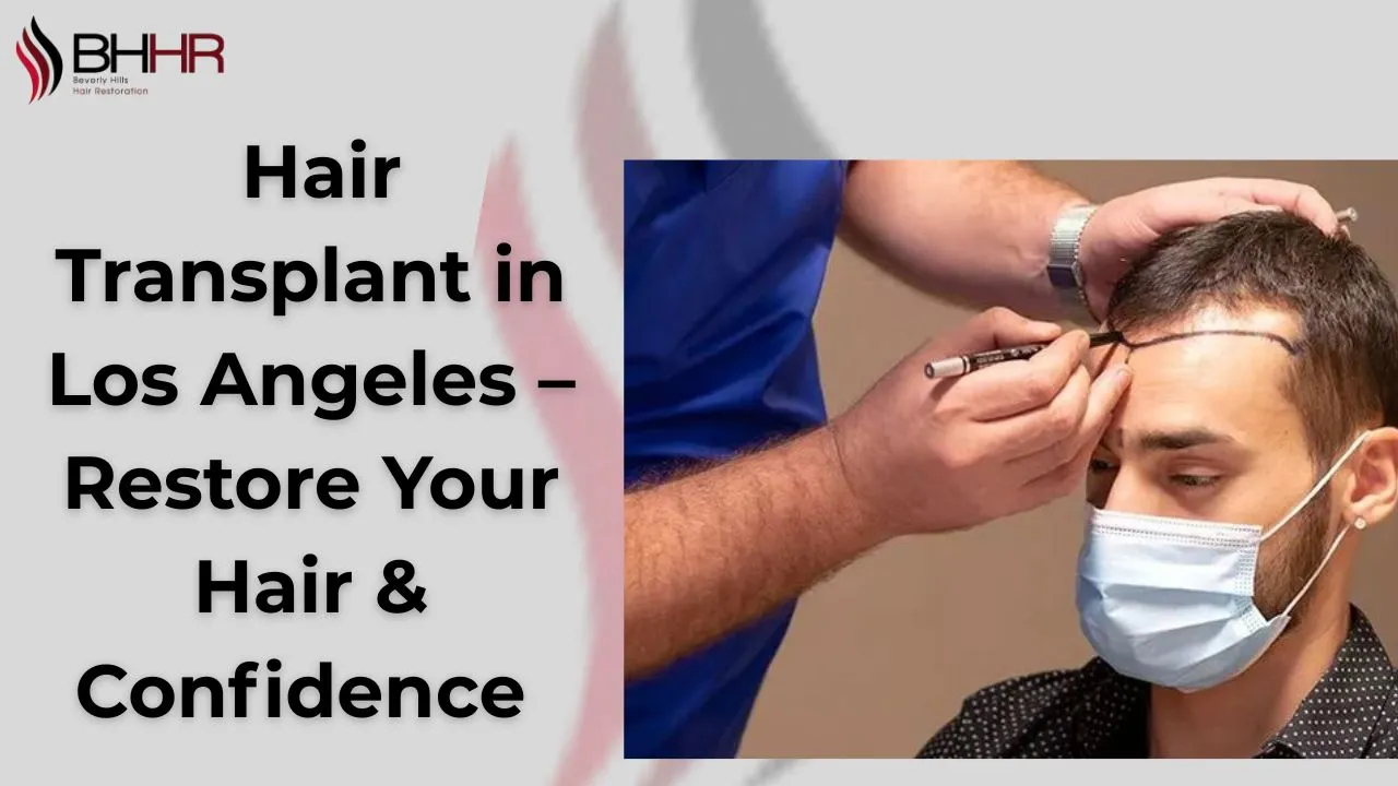 Hair Transplant in Los Angeles – Restore Your Hair & Confidence