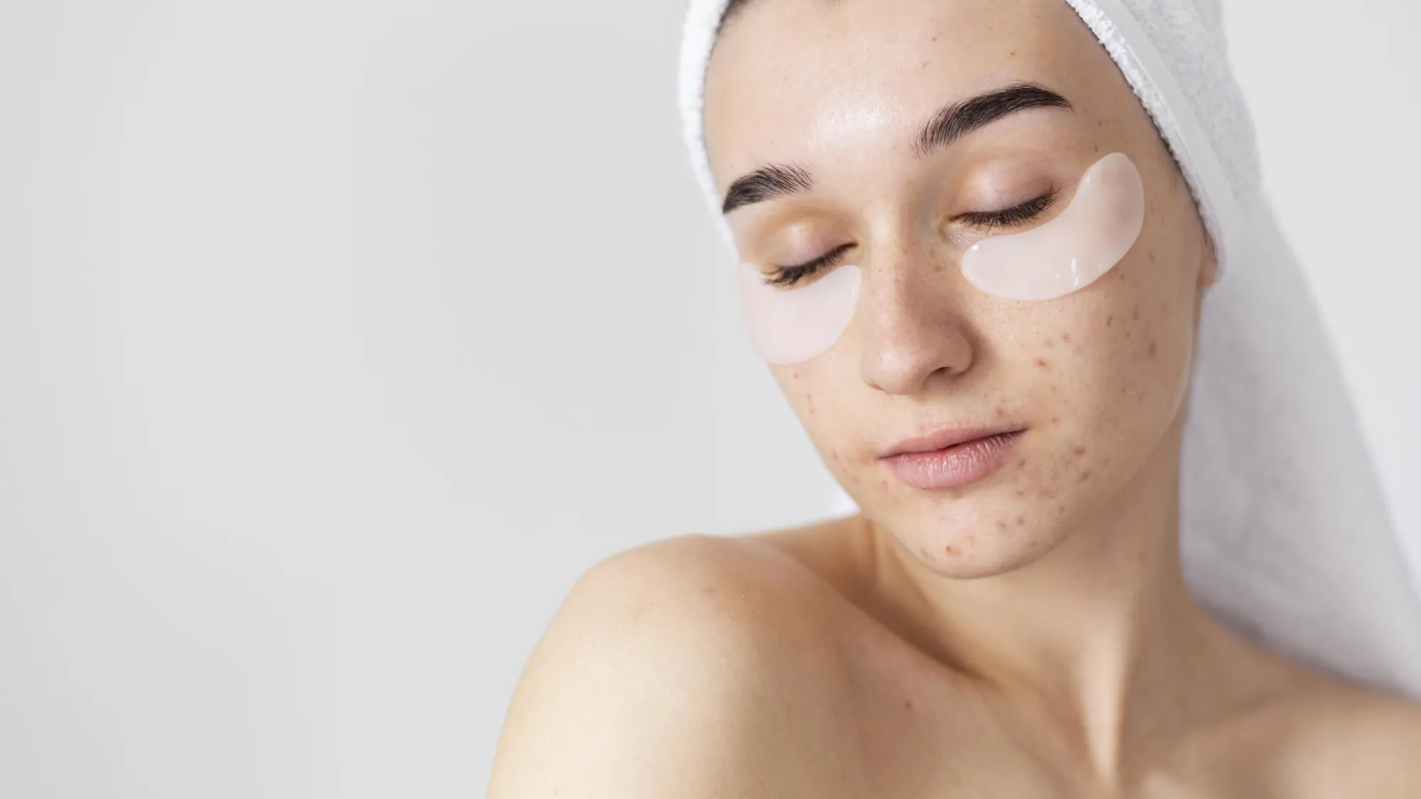 Dark Spots After Acne: How to Build a Gentle Korean Skincare Routine