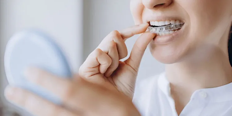 Invisible Braces Issues: Challenges Patients Face and How Experts Fix Them
