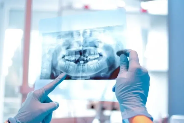 Dentist Northeast Philadelphia Offering Advanced Dental Crown Solutions for Lasting Smile Restoration and Protection