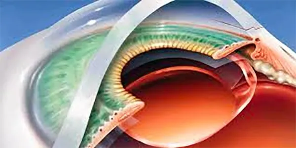 Understanding Intraocular Lenses Price and ICL Surgery Options