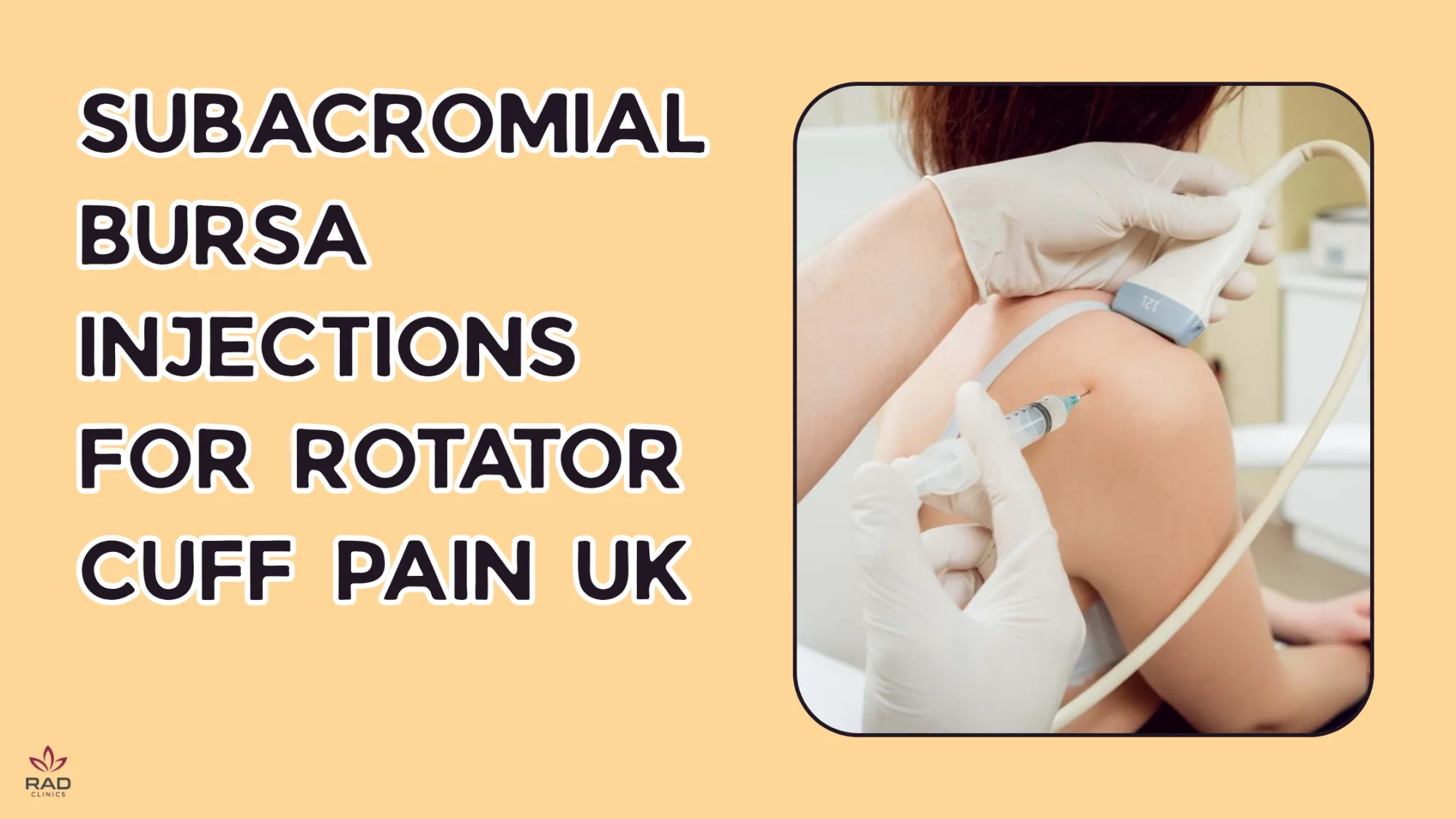 Ultrasound-Guided Subacromial Bursa Injections: Rapid Relief for Rotator Cuff Tendinopathy