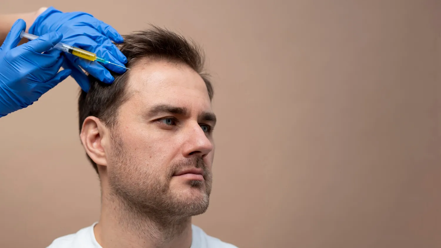 How Hair Loss PRP Treatment in Derby Works