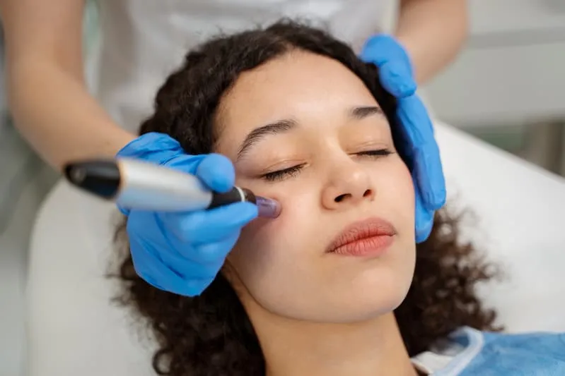 Laser Pigmentation Removal Bristol for Brighter and More Even Skin