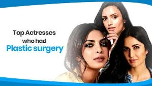 16 Top Actresses Who Had Plastic Surgery: Understanding Celebrity Cosmetic Enhancements