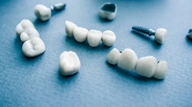 What You Should Know Before Planning Multiple Implants
