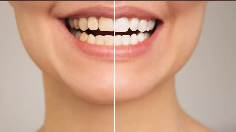 Guide to Premium Dental Care: Why We Are the Leading Dental clinic in Dubai