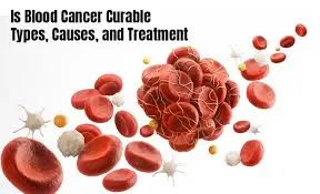 What is the Cost of Blood Cancer Treatment in India?