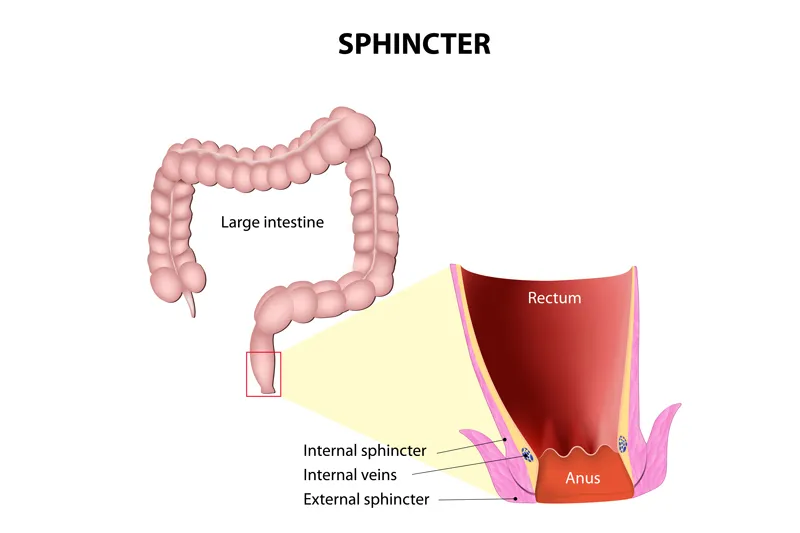 Sphincter Saving Surgery in India
