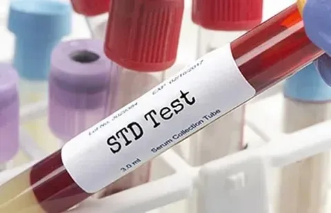 STD Test in Dubai: Confidential Care You Can Trust
