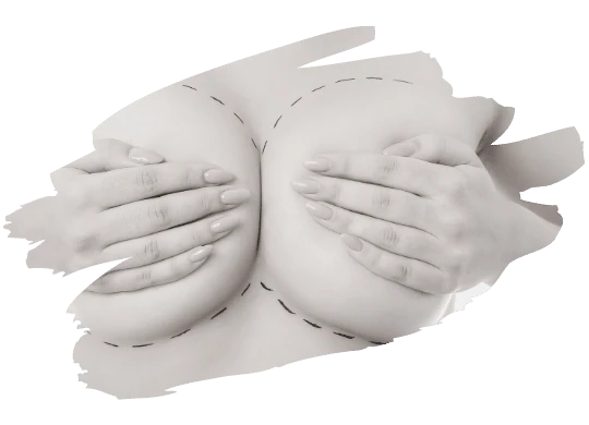 Vaser liposuction