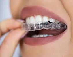 custom-fitted dental mouth guard