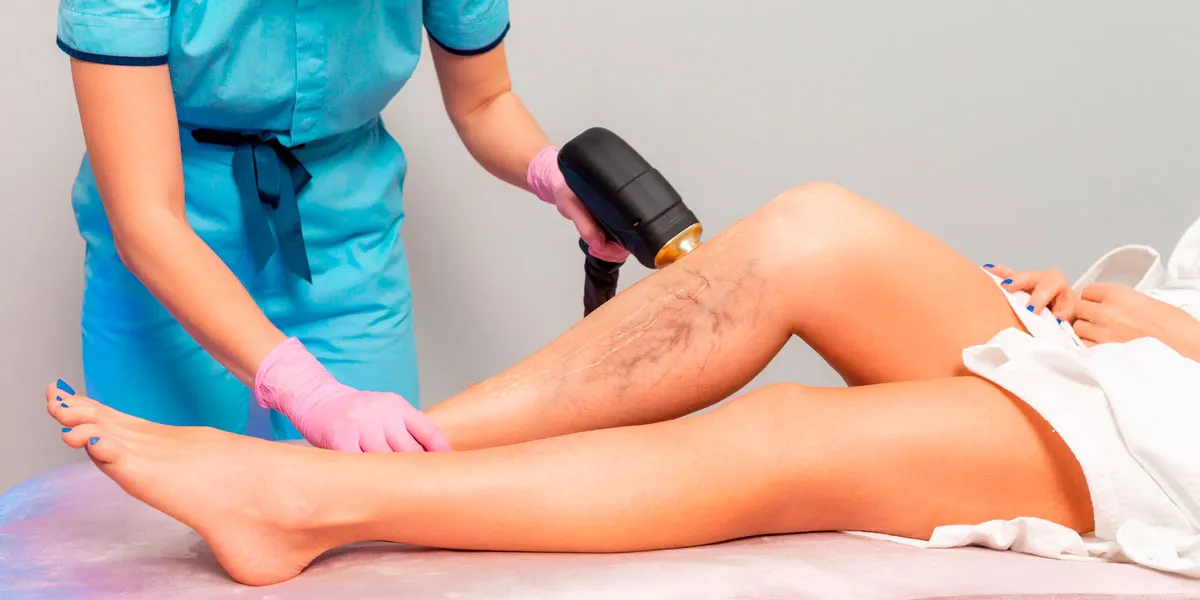 The First 48 Hours After Laser Spider Vein Care