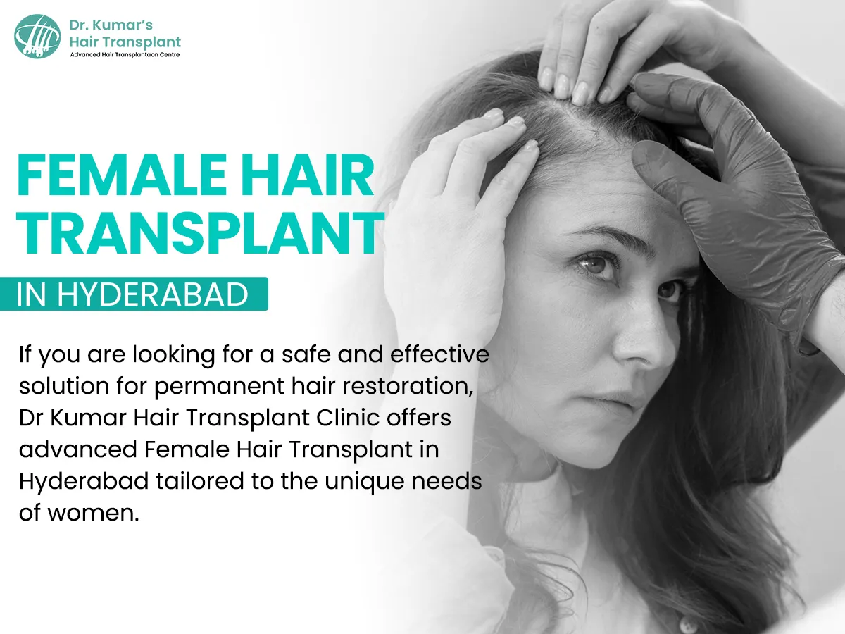 Hair Loss in Women and the Rise of FUE: What Every Patient Should Know
