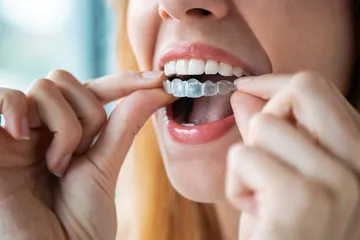 The Clear Choice for a Healthier and More Confident Smile