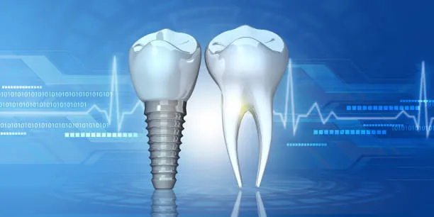 Why More Australian Adults Are Choosing Orthodontics in Liverpool Instead of Cosmetic Veneers