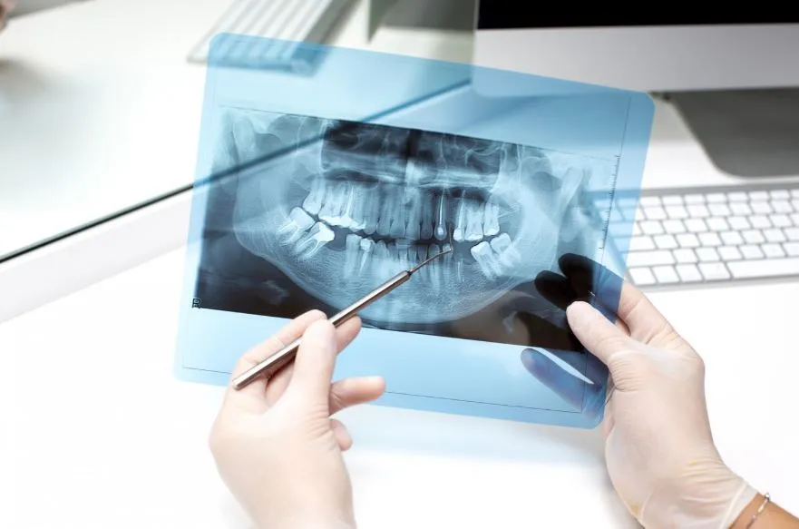Is a CBCT Scan Safe? Understanding Radiation Exposure