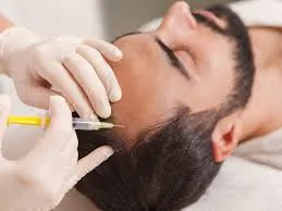 GFC Hair Treatment: Your Top Questions Answered