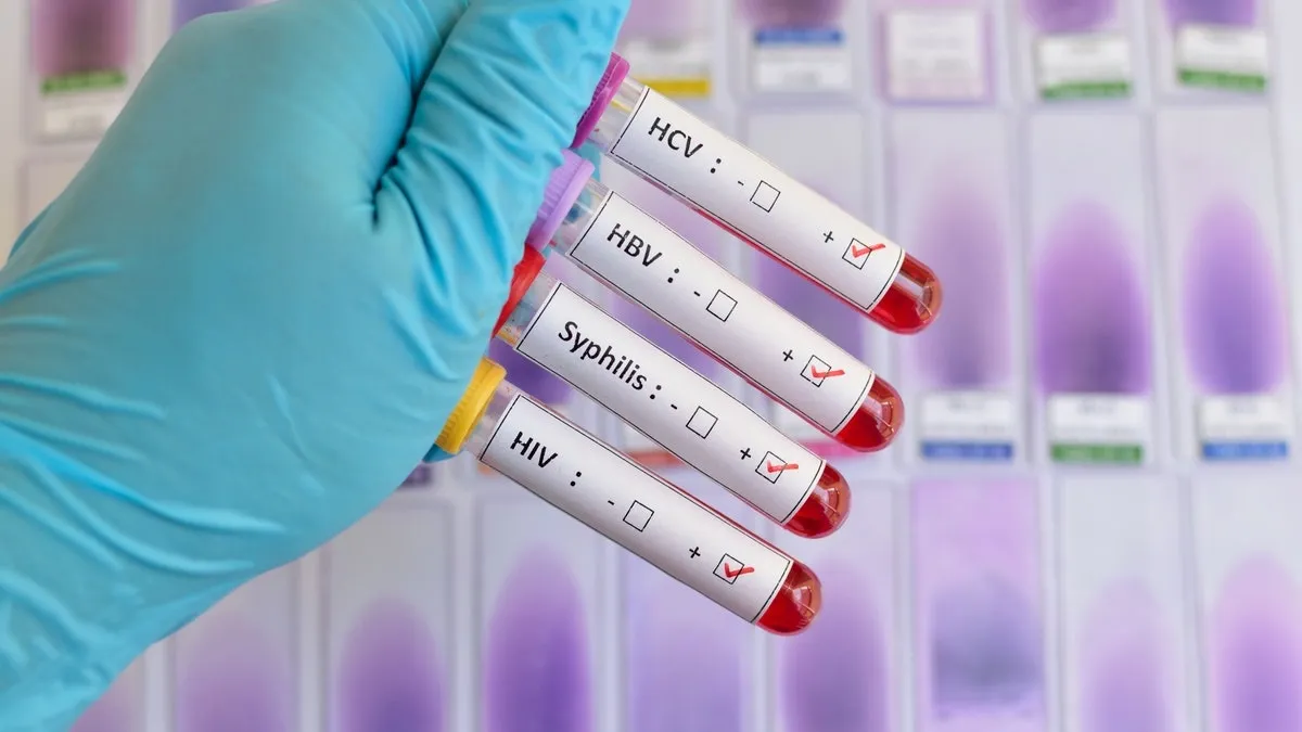 Free HIV and STD Testing – Take Control of Your Health