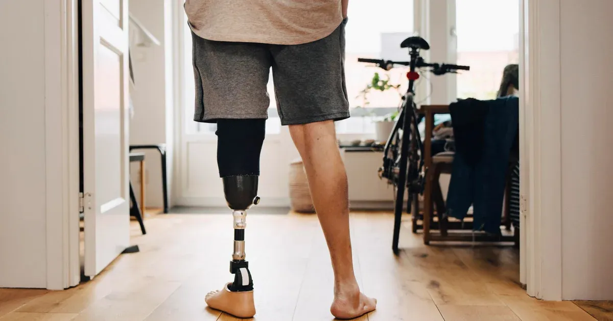 Looking for a Prosthetic Leg Below Knee Near Me? Here's How to Choose the Right Clinic